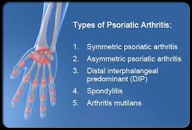 Psoriatic arthritis image