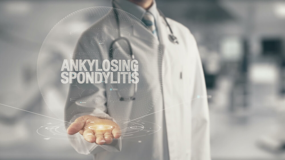 Arranging life insurance with  Spondylitis 